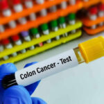 Unseen Cancer Threat: Is Your Age Group Next? Gloved hand holding colon cancer test tube