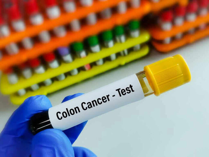 Gloved hand holding colon cancer test tube