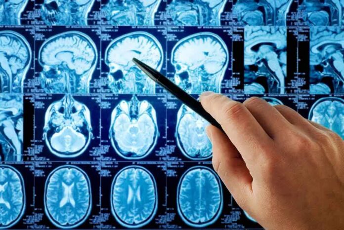 shutterstock_118491940 A hand pointing at MRI brain scans displayed on a screen