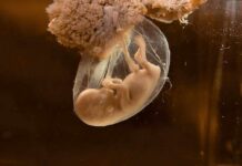 Backlash Erupts After Chilling Pregnancy Update A translucent jellyfish embryo suspended in a fluid-filled sac