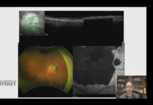 Macular Milestones 2026