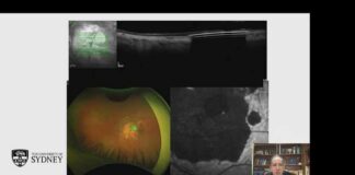 Macular Milestones 2026