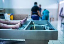 cadaver on stainless autopsy table in clinical room